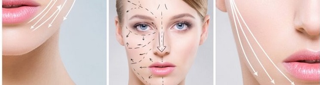 bioplastia, tres �reas